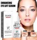 Ouhoe™ Serum Removedor De  Olheiras 1+1 Grátis